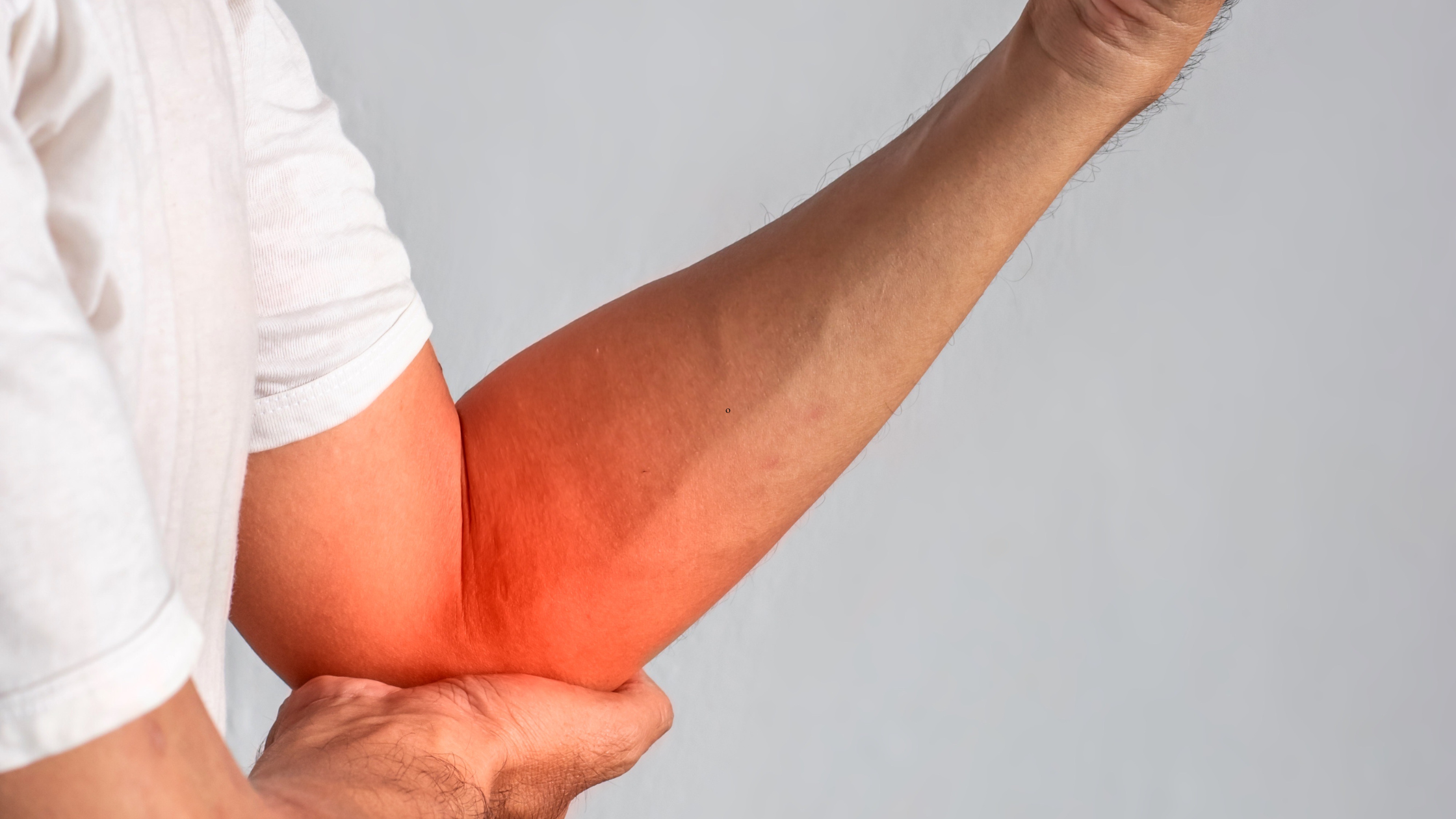 cubital tunnel syndrome