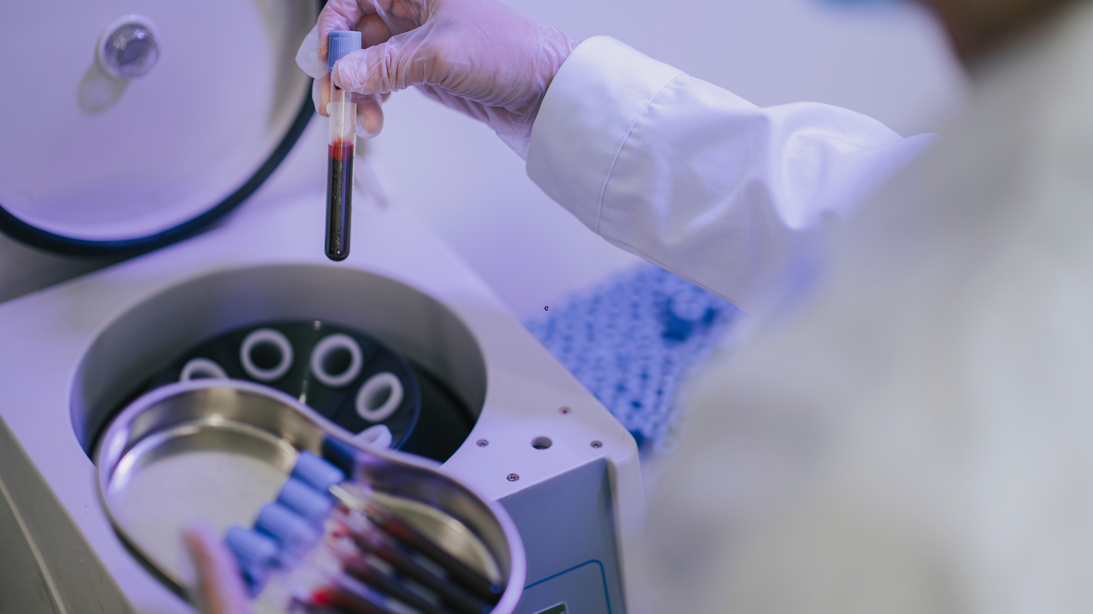 PPR for chronic joint injuries