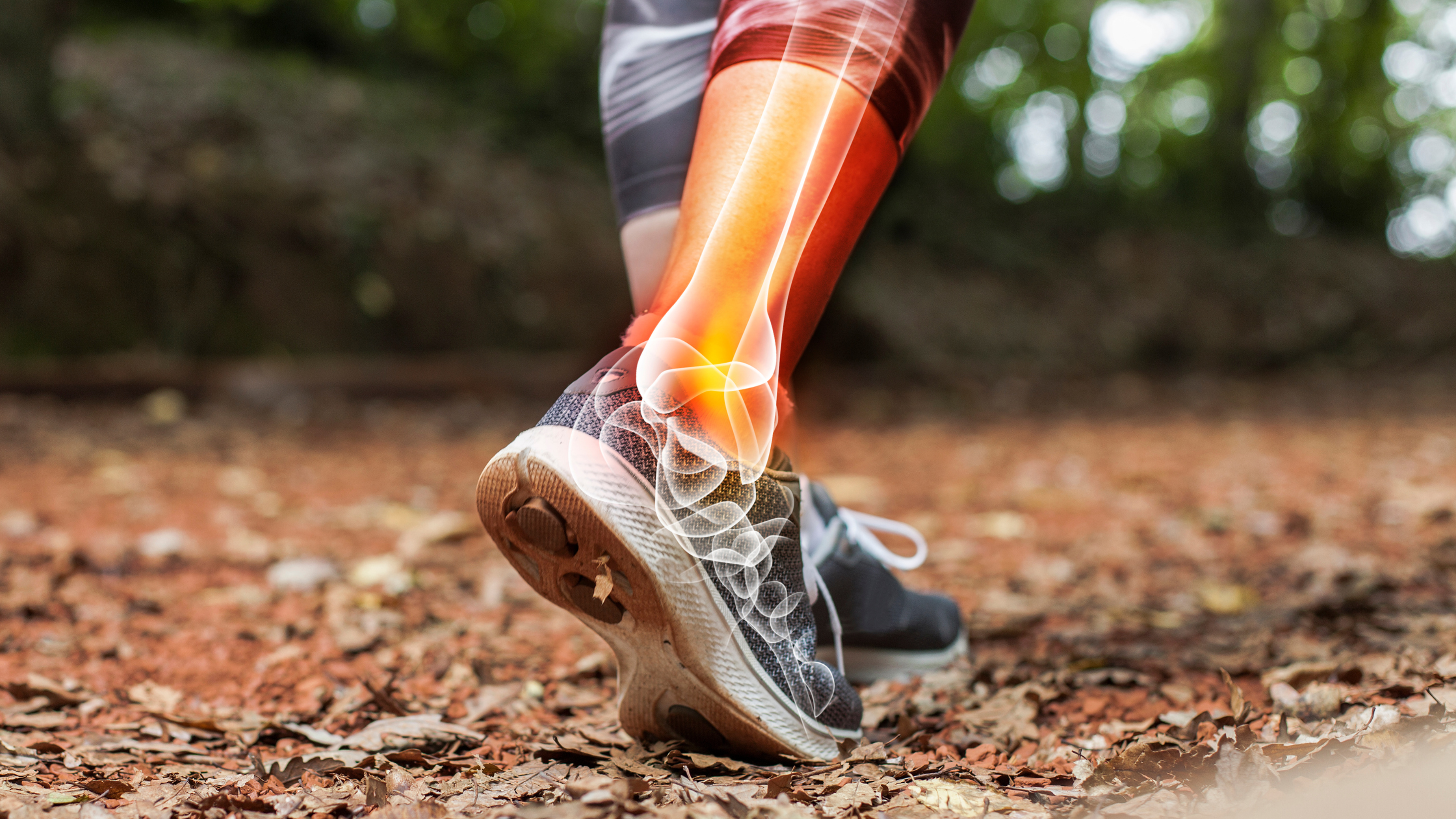 bone stress injuries